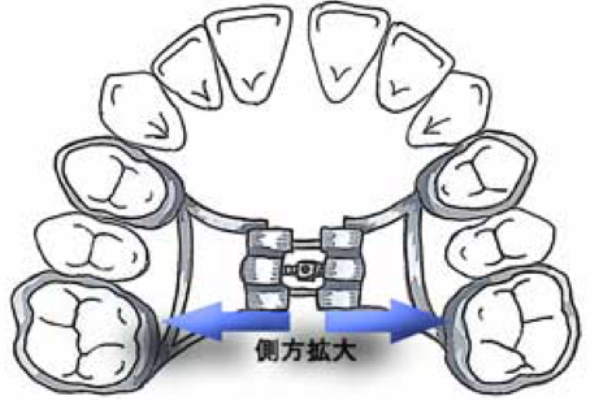 石巻　西村歯科医院の顎顔面矯正のメリットとデメリット