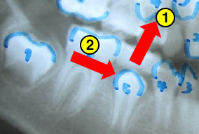 西村歯科医院　医院ブログ