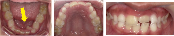 西村歯科医院 医院ブログ