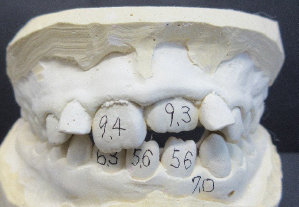 西村歯科医院　医院ブログ