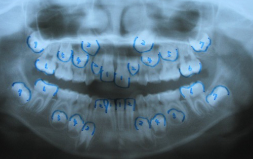 西村歯科医院 医院ブログ