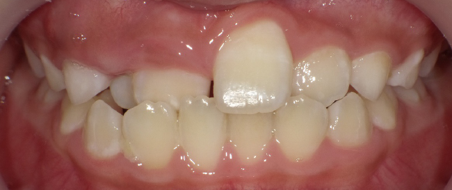 西村歯科医院　医院ブログ