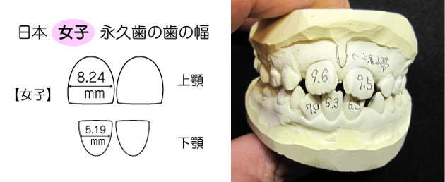 西村歯科医院 医院ブログ