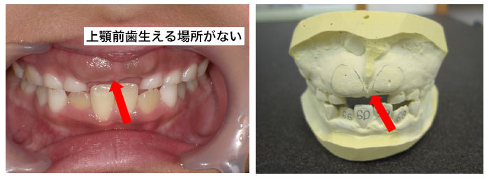 西村歯科医院　医院ブログ