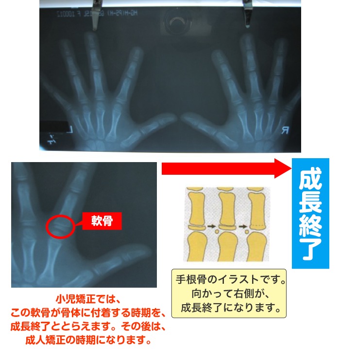 西村歯科医院　医院ブログ
