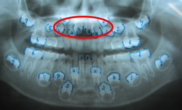 西村歯科医院　医院ブログ