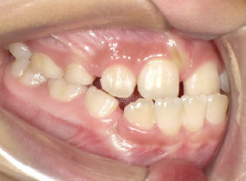 西村歯科医院　医院ブログ