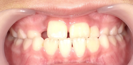 西村歯科医院　医院ブログ