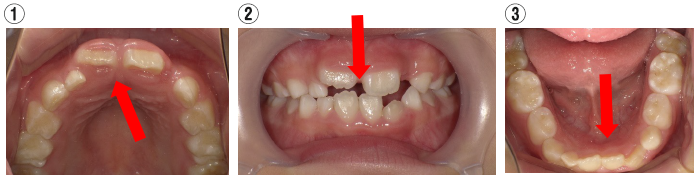 西村歯科医院　医院ブログ