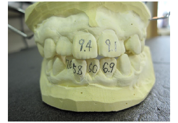 西村歯科医院 医院ブログ