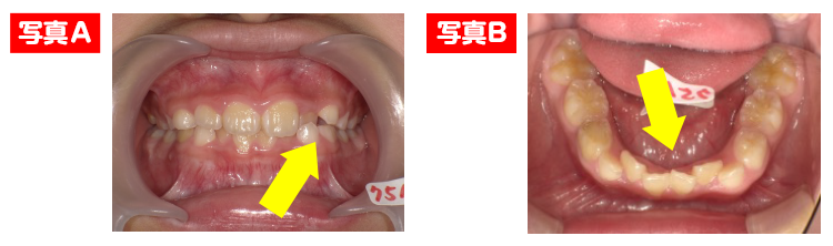 西村歯科医院 医院ブログ