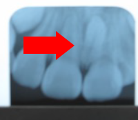 西村歯科医院　医院ブログ