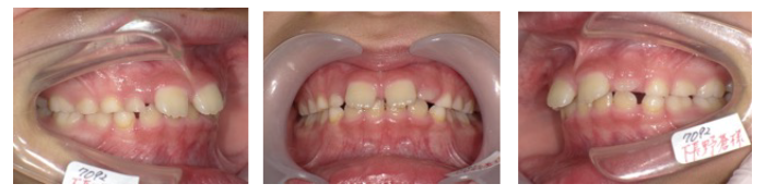 西村歯科医院 医院ブログ