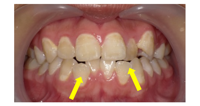 西村歯科医院 医院ブログ