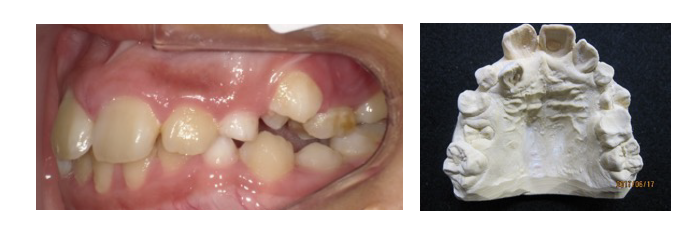 西村歯科医院 医院ブログ
