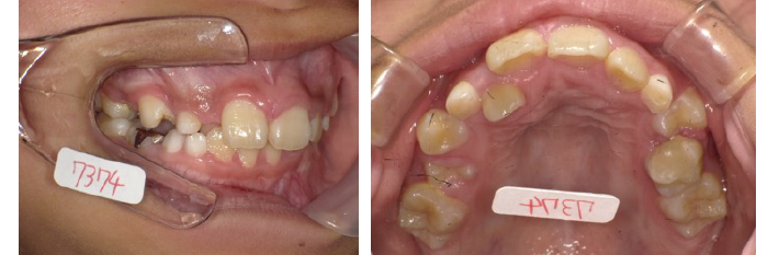 西村歯科医院 医院ブログ