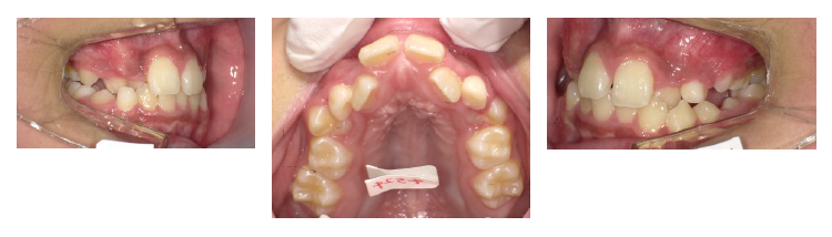 西村歯科医院 医院ブログ
