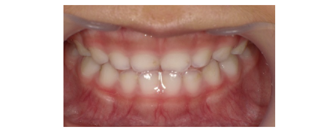 西村歯科医院 医院ブログ