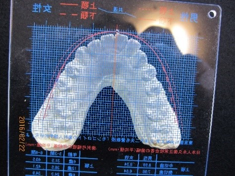 西村歯科医院 医院ブログ 